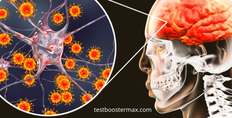 Tuberkulosis Meningeal Bahaya Infeksi Parah pada Sistem Saraf