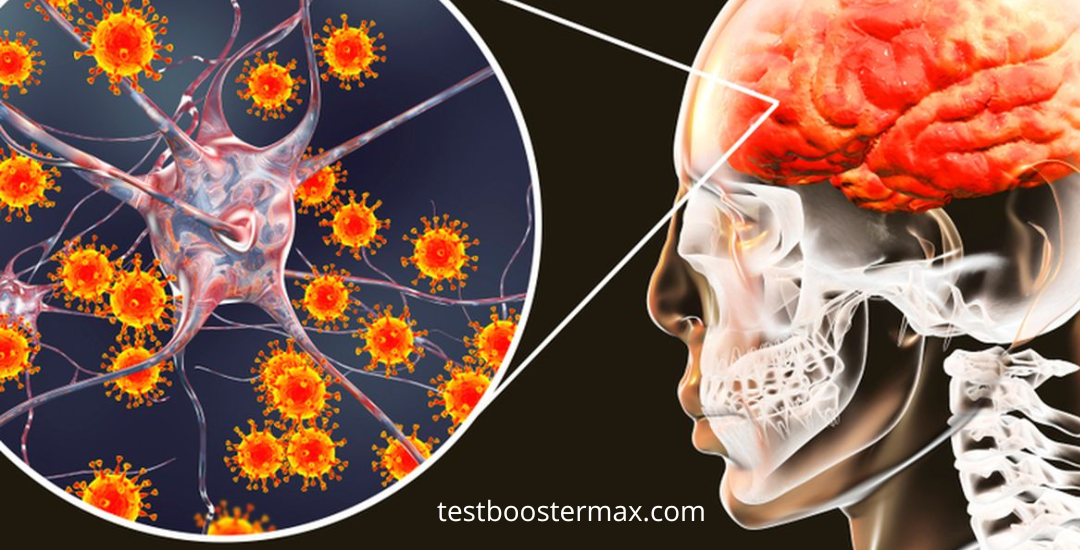 Tuberkulosis Meningeal Bahaya Infeksi