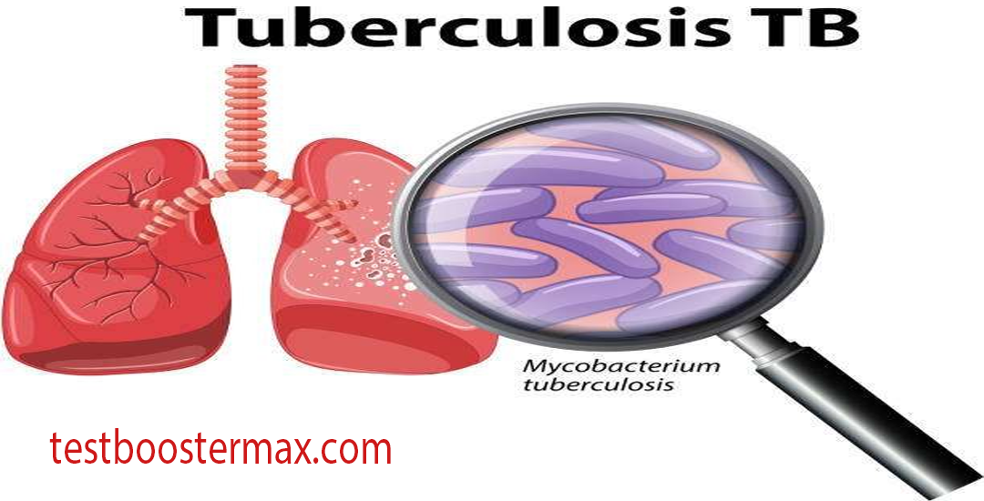 Tuberkulosis Penyakit Menular