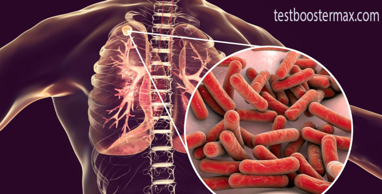 Faktor Risiko Tuberkulosis: Siapa Saja yang Berisiko