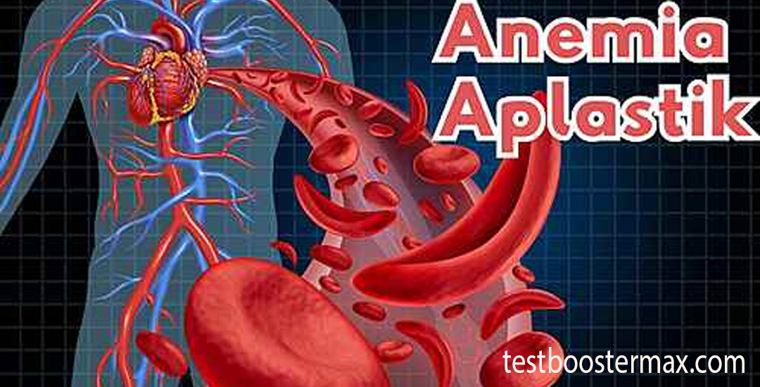 Anemia Aplastik Ketika Sumsum Tulang