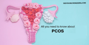 PCOS Penyebab, Gejala, Pengobatan, dan Pencegahan