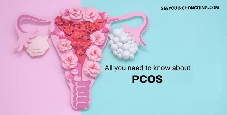 PCOS : Penyebab, Gejala, Pengobatan, dan Pencegahan