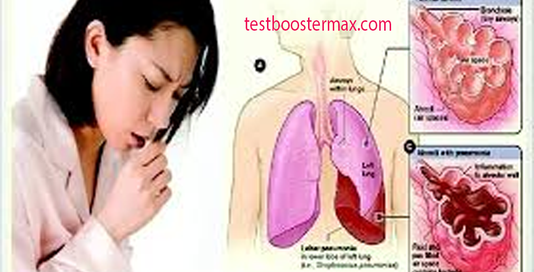 Tuberkulosis Penyakit Menular