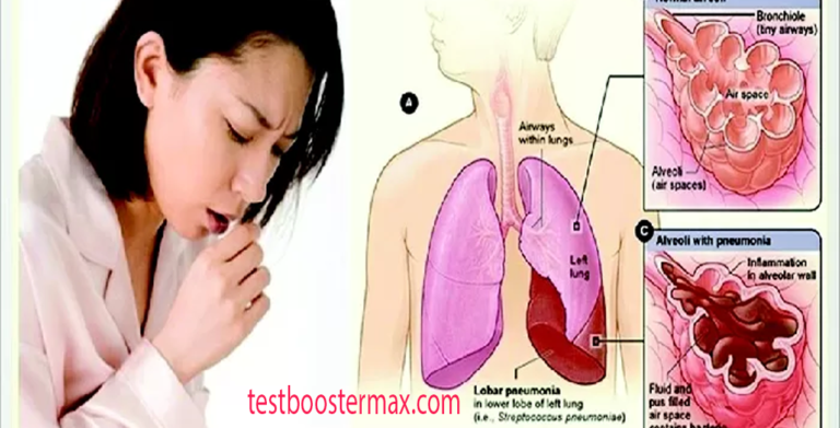 Waspada Agar Tidak Tertular dan Menularkan TBC