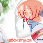 Menghadapi Tantangan Komunikasi Setelah Stroke