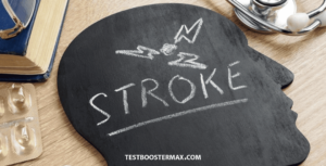 Stroke