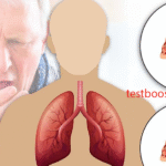 COPD Penyakit Paru Kronis yang Mengancam Kesehatan