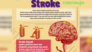 Stroke