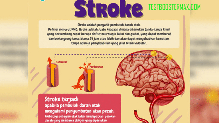 Stroke Penyakit Pembuluh Darah dengan Dampak Neurologis