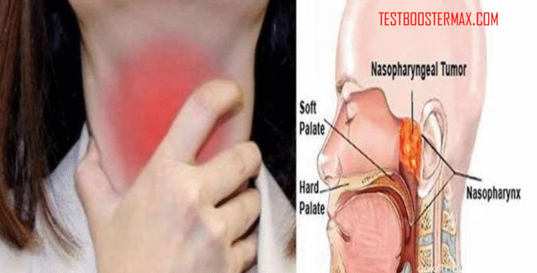 Penderita Kanker Nasofaring: Mengenal Penyakit, Gejala