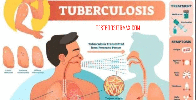 Penyakit Tuberculosis (TBC) untuk Kesehatan Keluarga