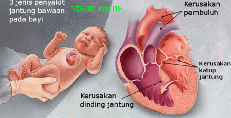 Gejala Penyakit Jantung Bawaan pada Bayi dan Anak