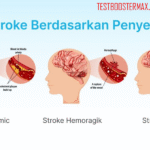 Stroke Berdasarkan Penyebabnya: Pemahaman Mendalam