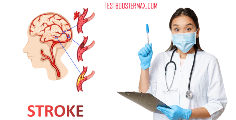 Stroke: Pengertian, Penyebab, Gejala, dan Penanganannya