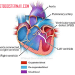 Truncus Arteriosus pada Bayi: Kondisi Langka yang Mengharuskan