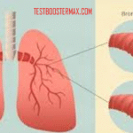 Penyakit Bronkitis Kronis: Pengertian, Penyebab, Gejala, Diagnosis, Pengobatan, dan Pencegahan