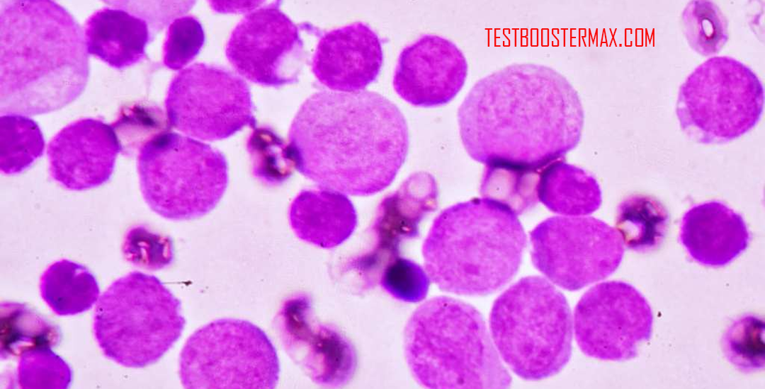Leukemia