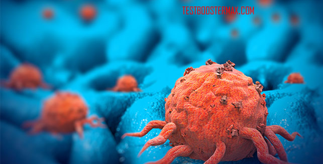 Leukemia Limfositik Kronis