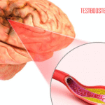 Transient Ischemic Attack (TIA): Stroke Ringan dengan Gejala Mirip Stroke