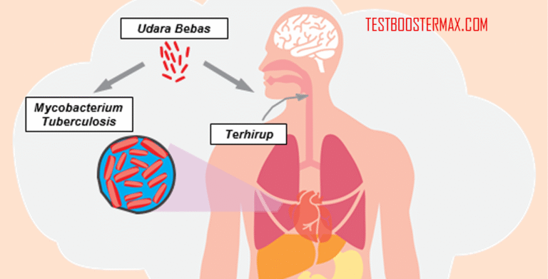 Tuberkulosis (TBC): Penyakit Infeksi yang Mengancam Kesehatan Global