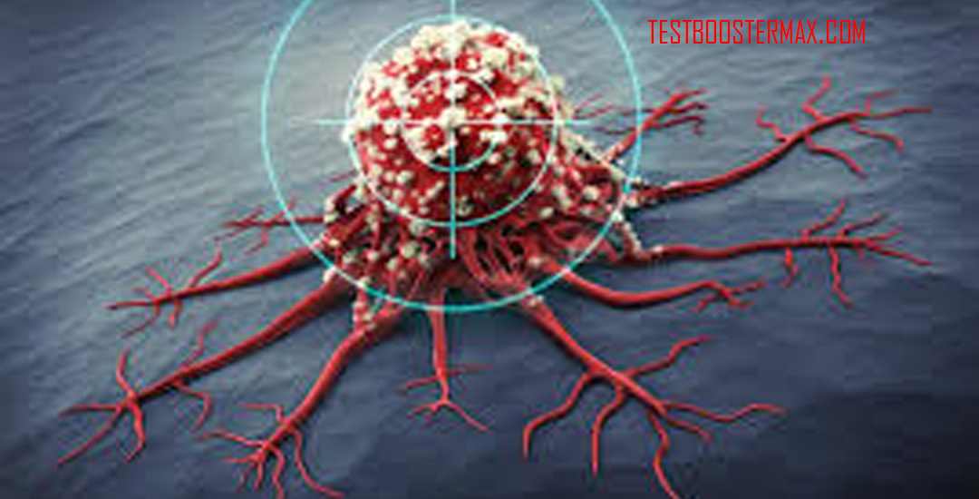Tumor Jantung