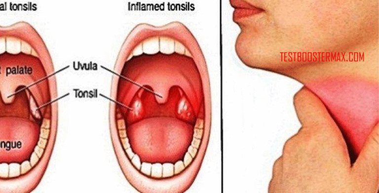 Penyakit Kanker Kerongkongan: Gejala, Penyebab, Diagnosis, dan Pengobatan