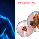 Karsinoma Timus: Jenis Kanker Langka dan Bersifat Agresif