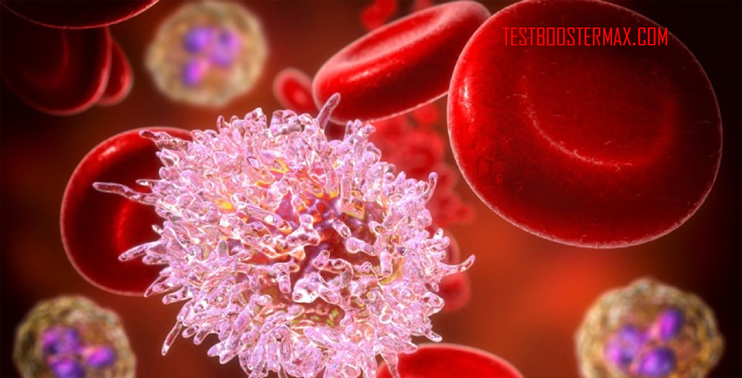 Leukemia Limfositik Kronis