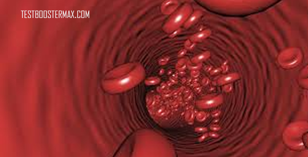 Leukemia Myeloid Akut